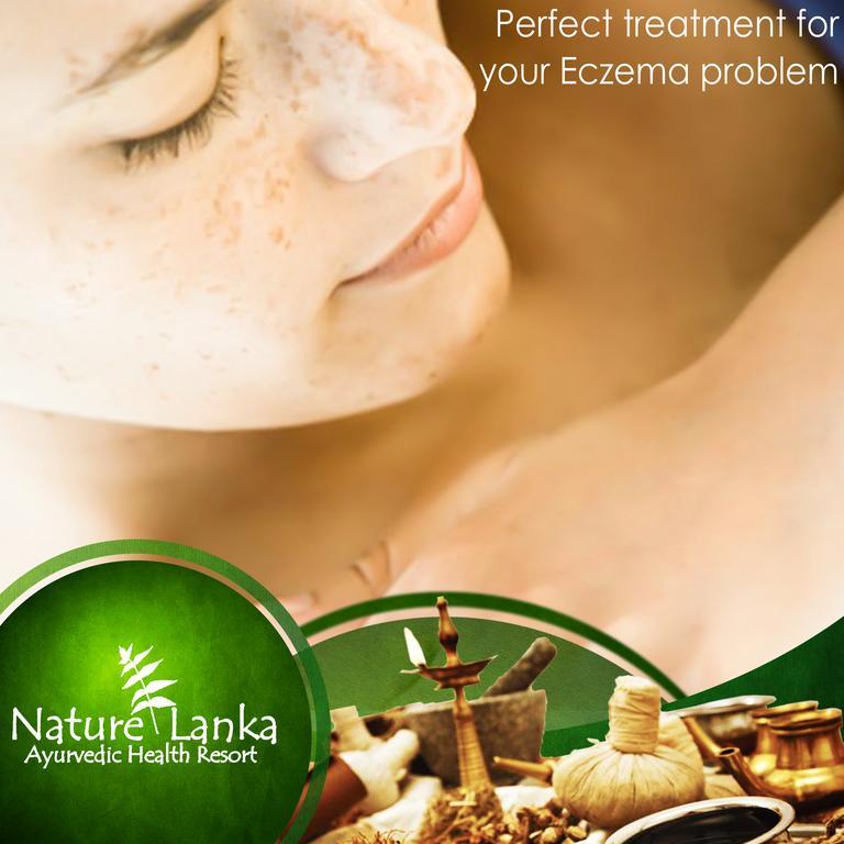 Nature Lanka Ayurveda Resort - All Meals And Ayurveda Treatments With Yoga Тангалла Экстерьер фото